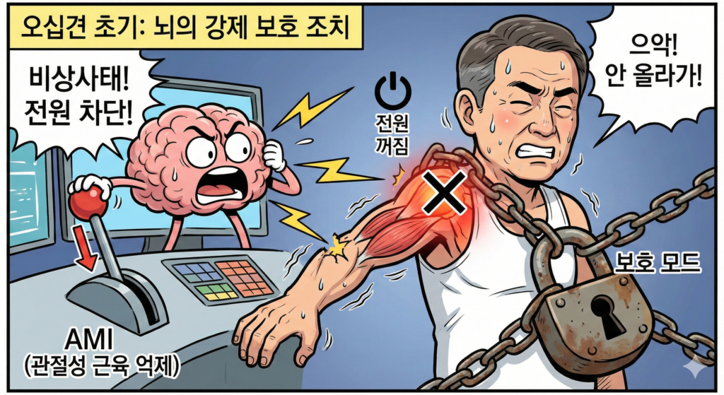 오십견에서 관절성 근육억제(arthrogenic muscle inhibition)의 메커니즘