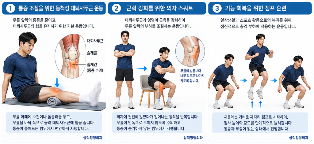 그림 3 슬개건병증 단계별 운동: 대퇴사두근 등척성 운동, 느린 의자 스쿼트, 후기 점프와 착지
