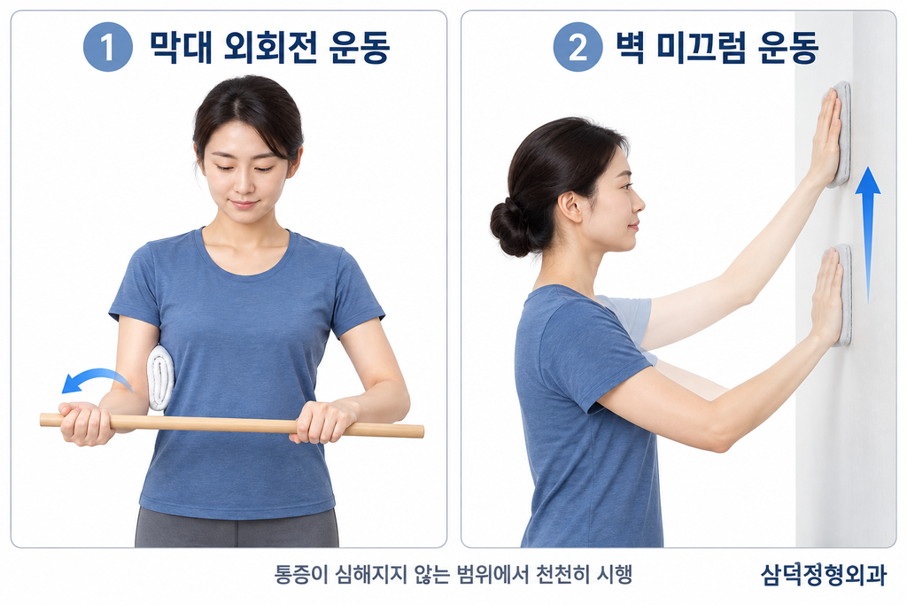 오십견 재활운동 진행단계